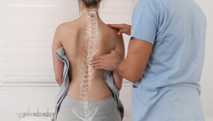 Scoliosis – Symptoms and best and worst food choices