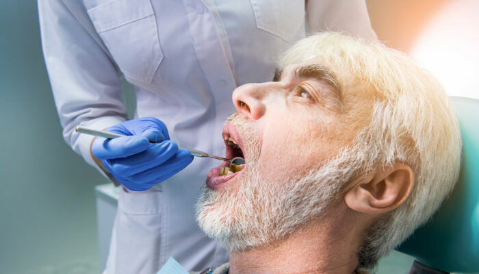 Top 10 benefits of dental implants for seniors