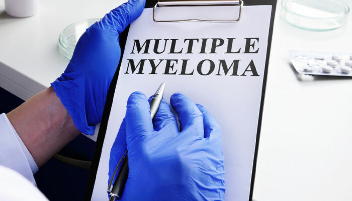 Multiple Myeloma – Symptoms, and Management Tips