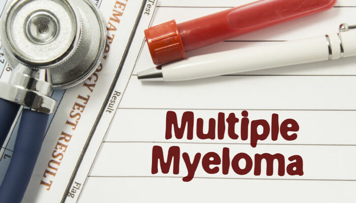 Never Ignore These 7 Signs of Multiple Myeloma