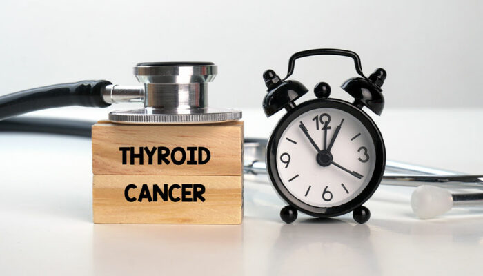 Thyroid cancer – Causes, Symptoms, and management