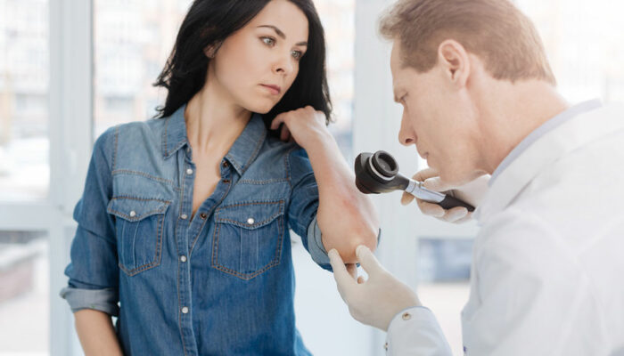 Psoriasis – Symptoms, Causes, and Management