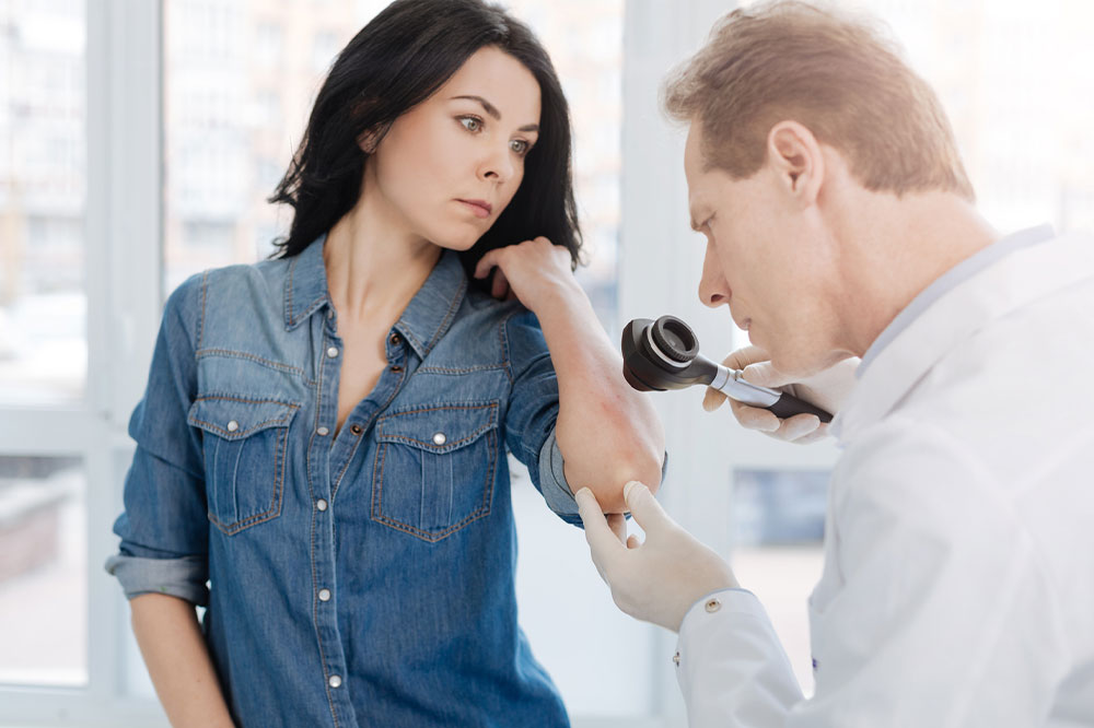 Psoriasis – Symptoms, Causes, and Management