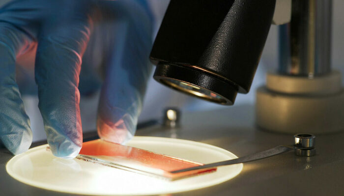 6 ways to manage hemophilia